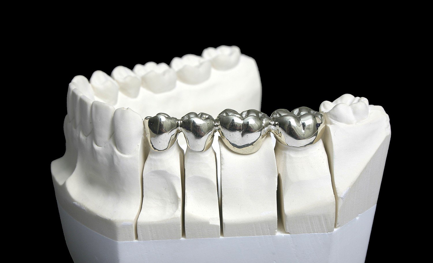 Dentistry Metal Refining